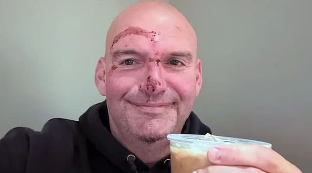 Fetterman: "doctors put me back together"